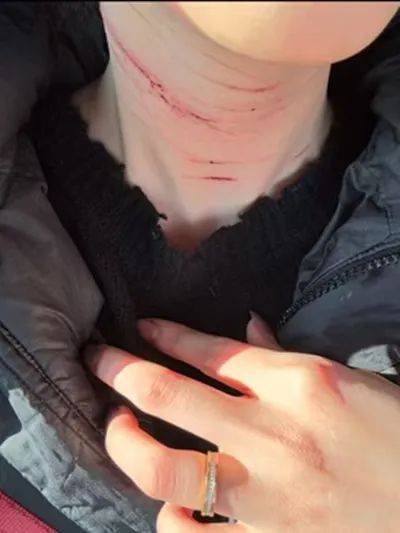 前男友公开金赛纶自残照，称她的死与金秀贤无关